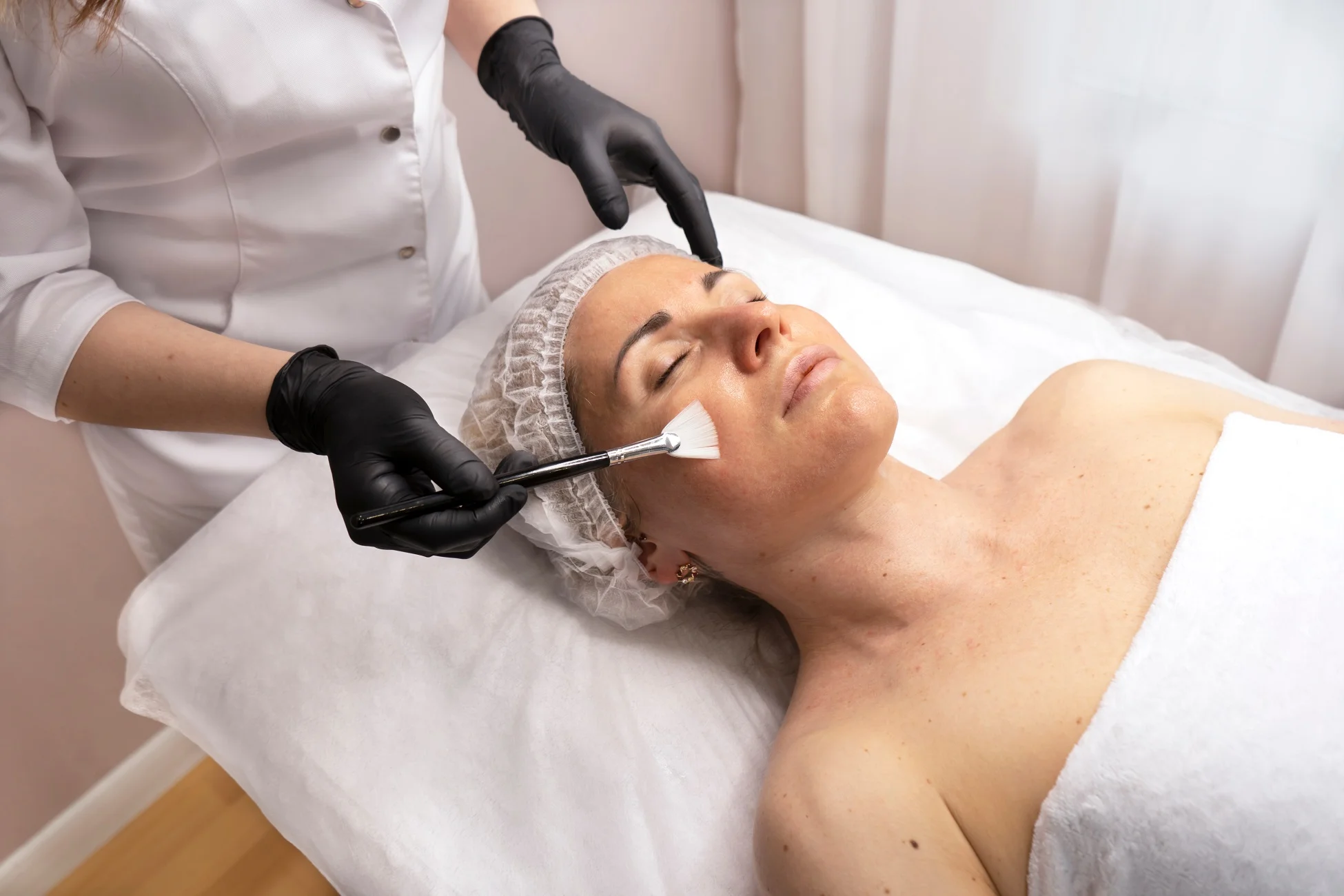 Chemical Peels in Long Beach, CA | Lounge of Beauty Medical Spa