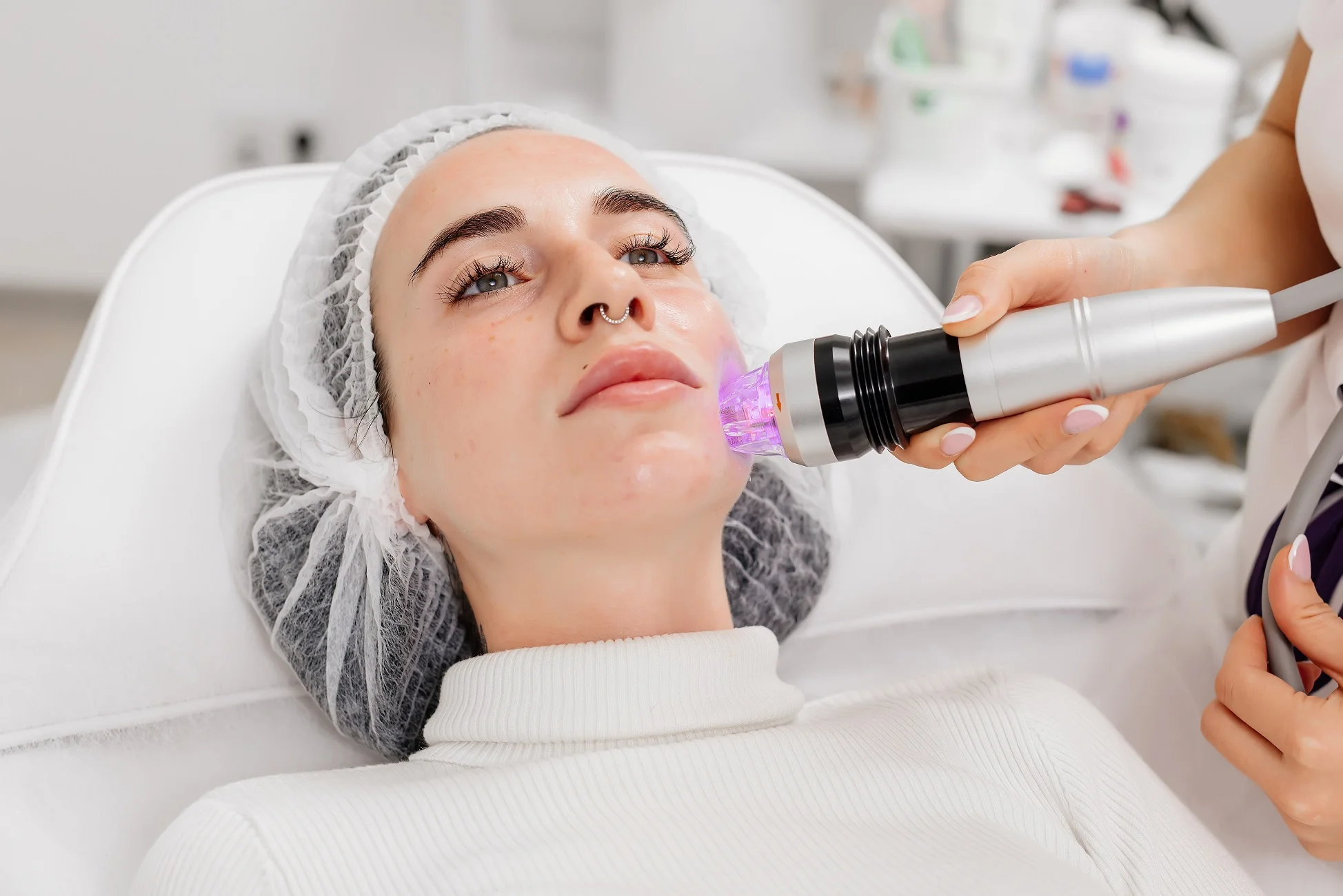 RF Microneedling in Long Beach, CA | Lounge of Beauty Medical Spa