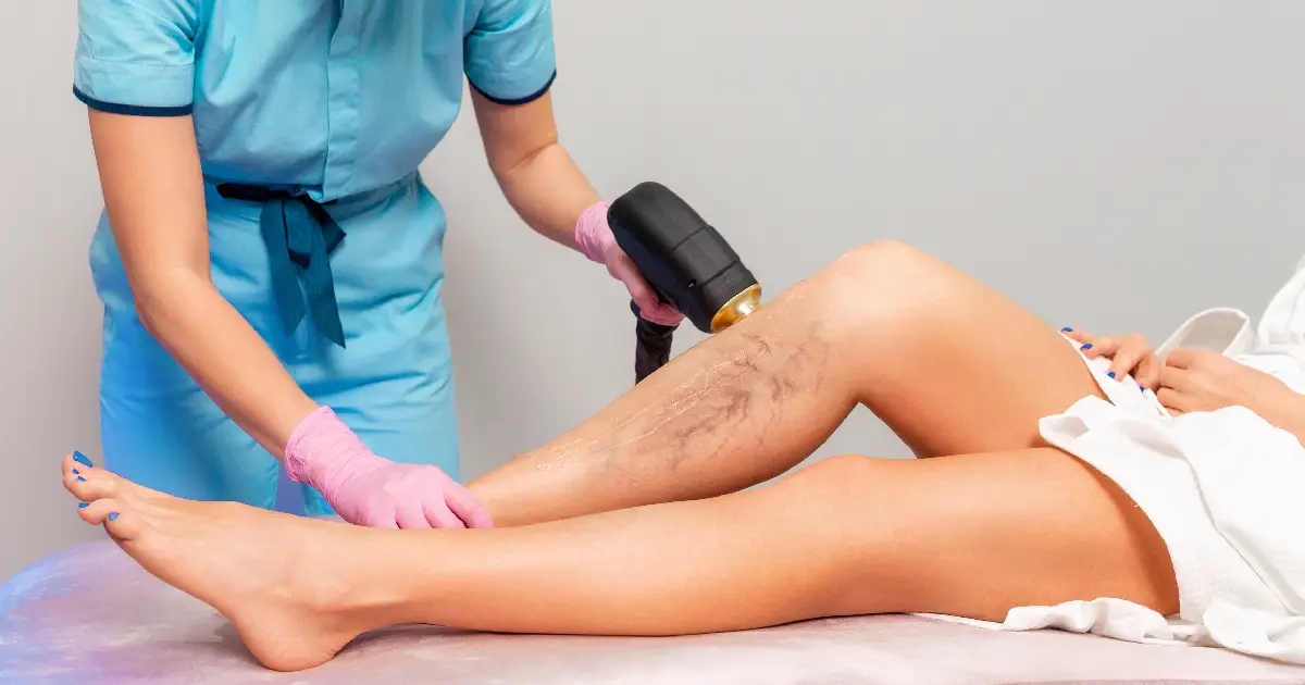 Women Receiving Laser Vein Treatment in Long Beach, CA